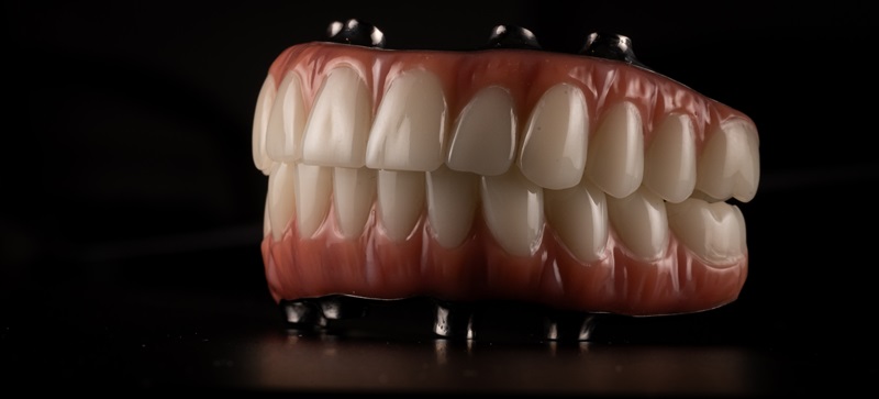 Full Arch Dental Restoration