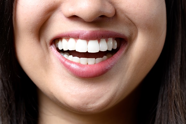 When To Consider A Full Mouth Reconstruction