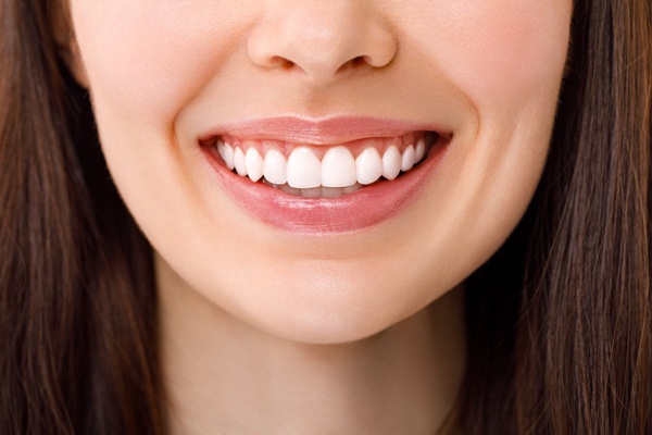 Take Home Teeth Whitening Trays From Your Dentist
